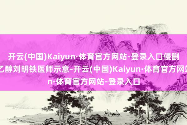 开云(中国)Kaiyun·体育官方网站-登录入口侵删2、香烟与乙醇刘明铁医师示意-开云(中国)Kaiyun·体育官方网站-登录入口