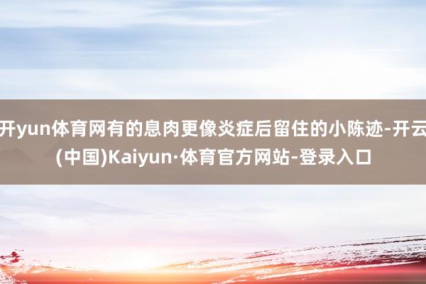 开yun体育网有的息肉更像炎症后留住的小陈迹-开云(中国)Kaiyun·体育官方网站-登录入口